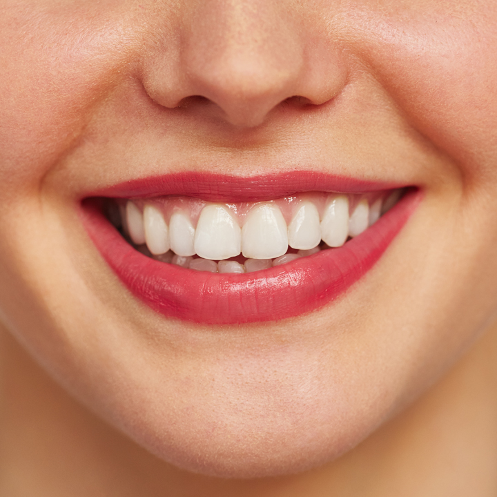 Before - Yellow teeth
