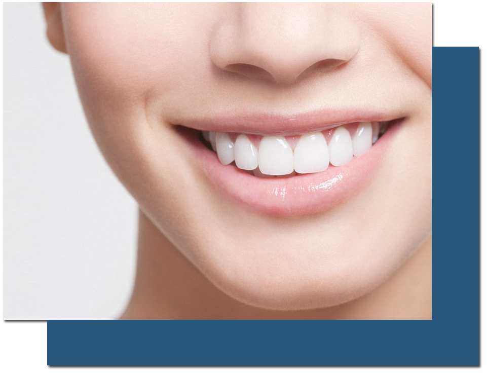 Smile Makeover at KKS Dental and Medical Care